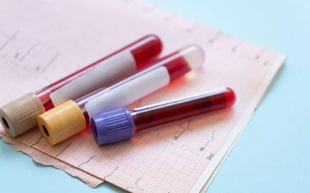 Erken tanıda devrim: 50’den fazla kanser türünü tespit eden kan testi