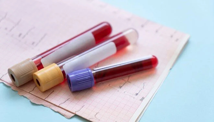 Erken tanıda devrim: 50’den fazla kanser türünü tespit eden kan testi