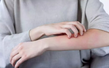 Kış egzaması alarmı! Uzmanlardan kritik uyarı: Bu hatayı yapmayın