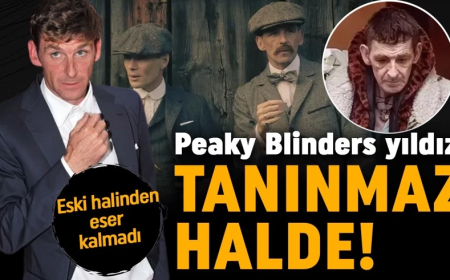 Peaky Blinders yıldızı tanınmaz halde! Eski halinden eser kalmadı
