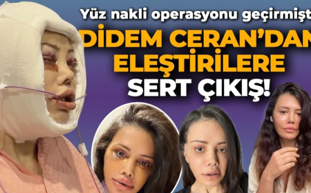 Yüz nakli operasyonu geçirmişti! Didem Ceran'dan eleştirilere sert çıkış