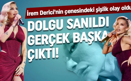 İrem Derici'nin çenesindeki şişlik olay oldu! Dolgu sanıldı, gerçek ortaya çıktı