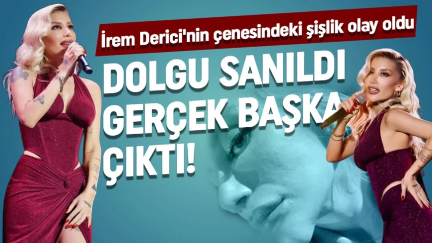 İrem Derici'nin çenesindeki şişlik olay oldu! Dolgu sanıldı, gerçek ortaya çıktı